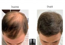 Căderea părului și scalpul vizibil: ce soluții ai pentru un păr cu aspect mai des?